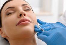 What Are the Advantages of Radiesse Injections at Celibre in Torrance