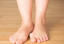 Why Do Bunions Require Surgery