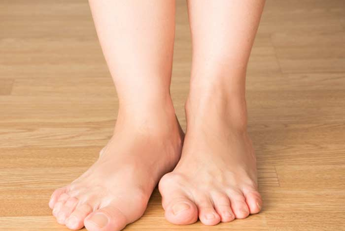 Why Do Bunions Require Surgery