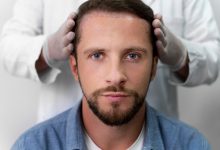 What Should I Do If I Notice Shock Loss After a Hair Transplant