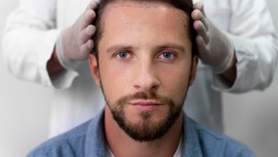 What Should I Do If I Notice Shock Loss After a Hair Transplant