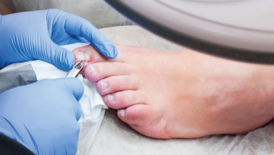 What Symptoms Indicate Progress in Toenail Removal Healing Stages